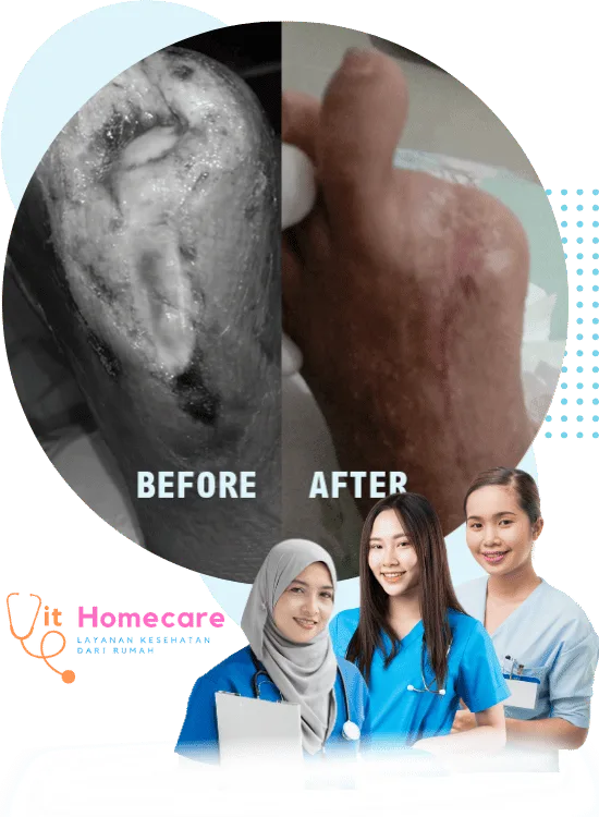 jasa perawatan luka